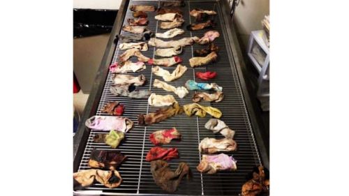 Kaos kaki yang berhasil dikeluarkan dari perut anjing. Foto by : AP/DoveLewis Emergency Animal Hospital.
