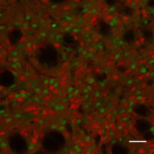 Gambar perbesaran striatum otak tikus mengungkapkan neuron (sel saraf) yang terlibat dalam sirkuit otak yang mengatur kebiasaan. Bertentangan dengan lampu lalu lintas, neuron dalam jalur “terus” dari striatum berwarna merah, dan neuron “berhenti” tampak hijau.(Credit: Kristen Ade, Duke University)