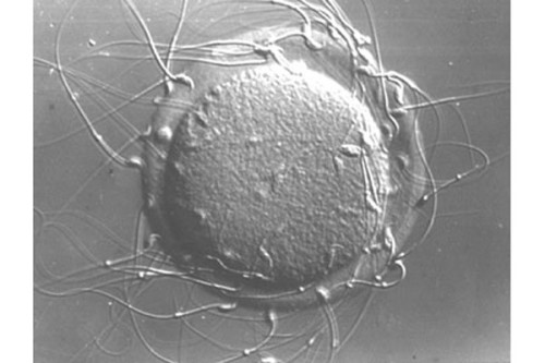 Ilustrasi--Sel-sel sperma tikus di zona pellucida sel telur tikus. (Icahn School of Medicine)