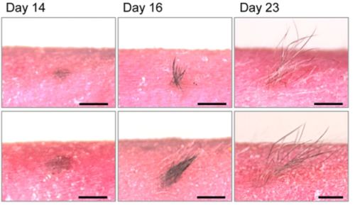 Para peneliti melihat kulit ditransplantasikan akan melalui siklus pertumbuhan rambut normal.
